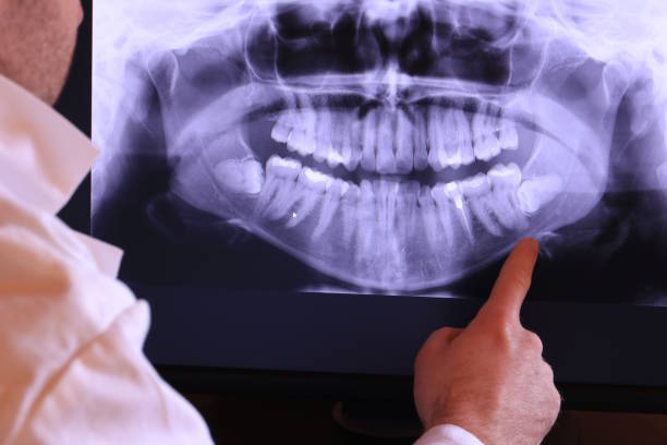 Best Pediatric Emergency Dentist in Los Alamos, CA